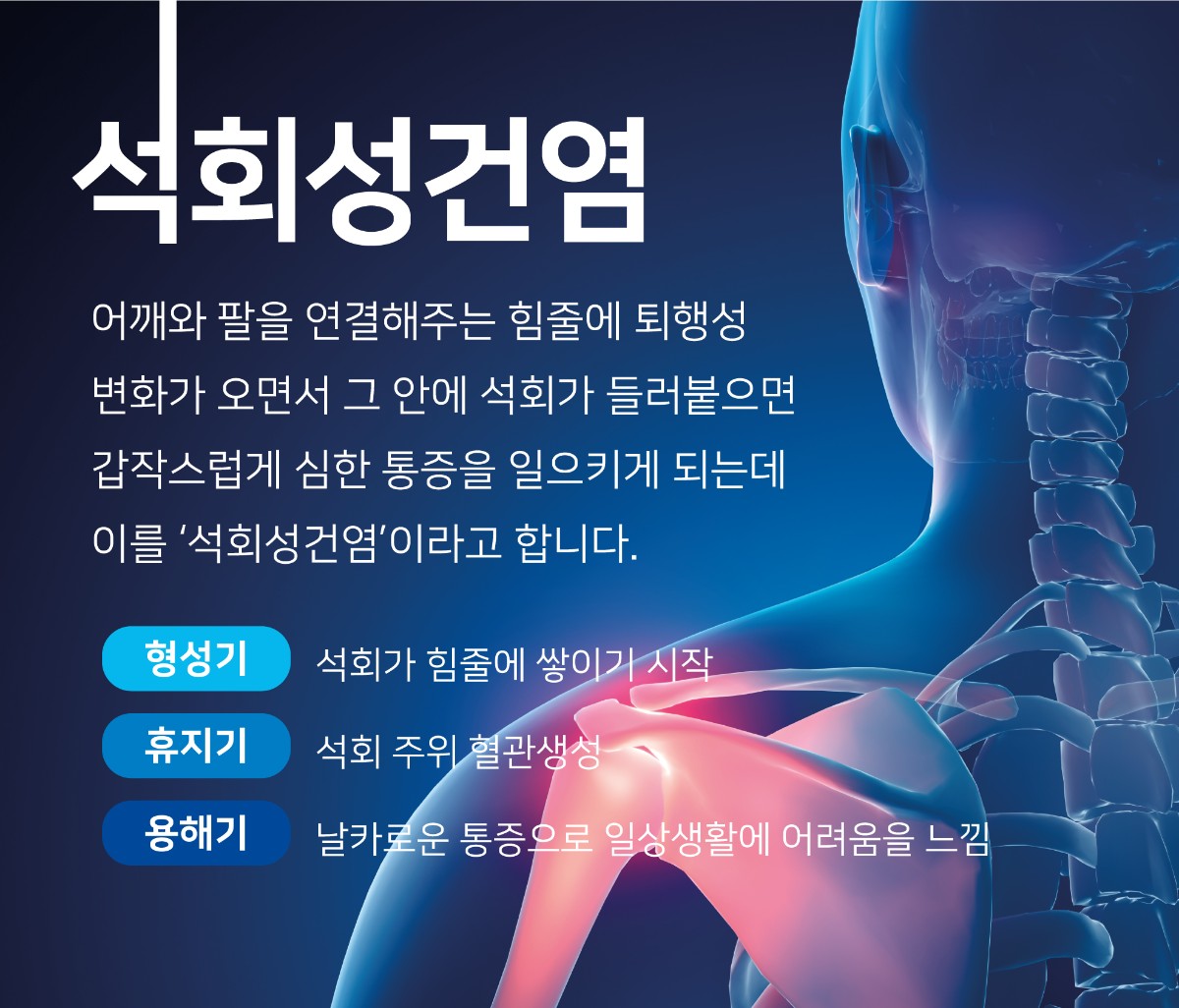 갈현동정형외과, 어깨통증 유발하는 석회성 건염의 비수술적 치료와 예방 전략 (2).jpg