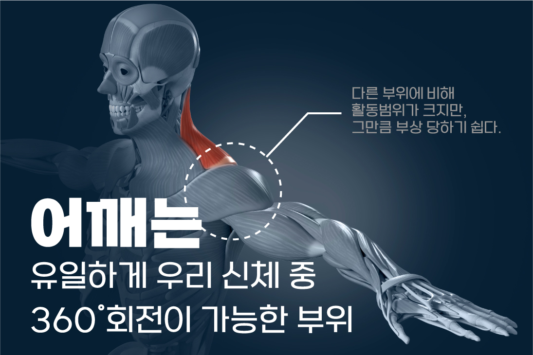 진관동정형외과, 찌르는 듯한 어깨 통증 석회성 건염 (5).jpg