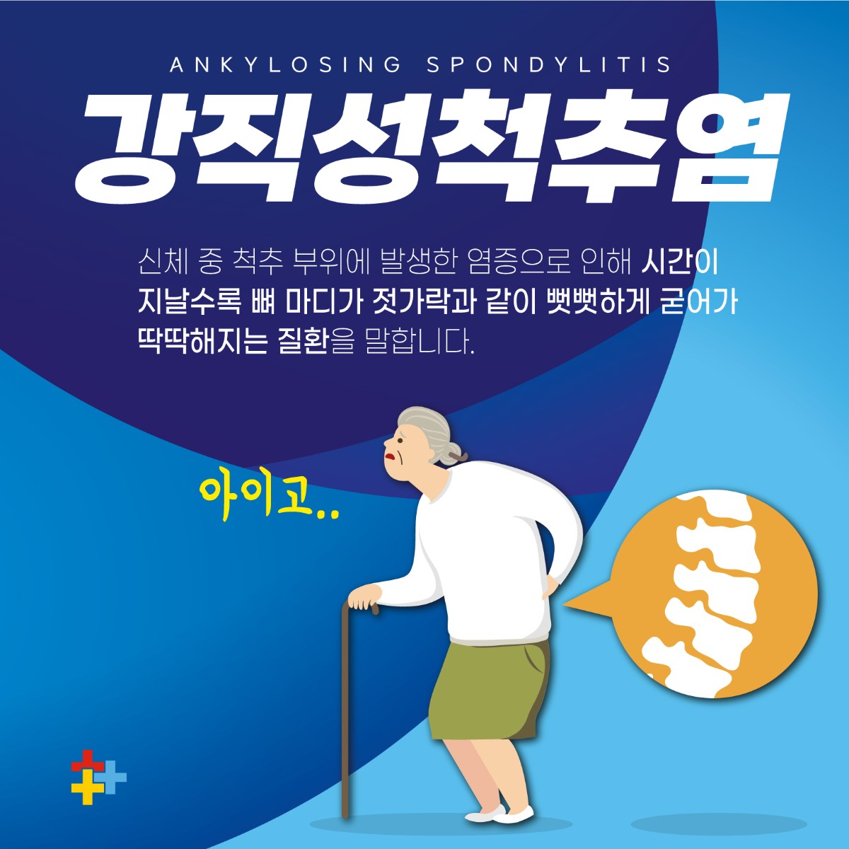 갈현동정형외과, 매일 아침 허리 뻣뻣 강직성 척추염의 경고 신호 (6).jpg