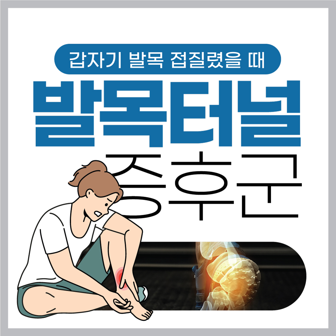 불광동정형외과, 통증 없는 일상 발목터널증후군 예방과 관리 (3).jpg