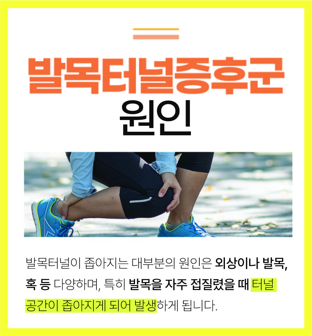 불광동정형외과, 통증 없는 일상 발목터널증후군 예방과 관리 (4).jpg