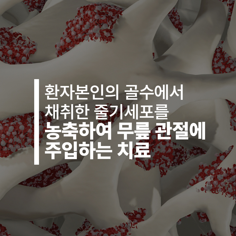 자가골수줄기세포주사-치료.jpg