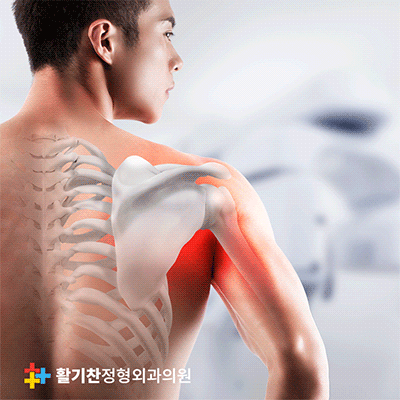 은평구정형외과, 회전근개파열 예방하고 통증 없이 활기찬 일상 누리기 (2).gif