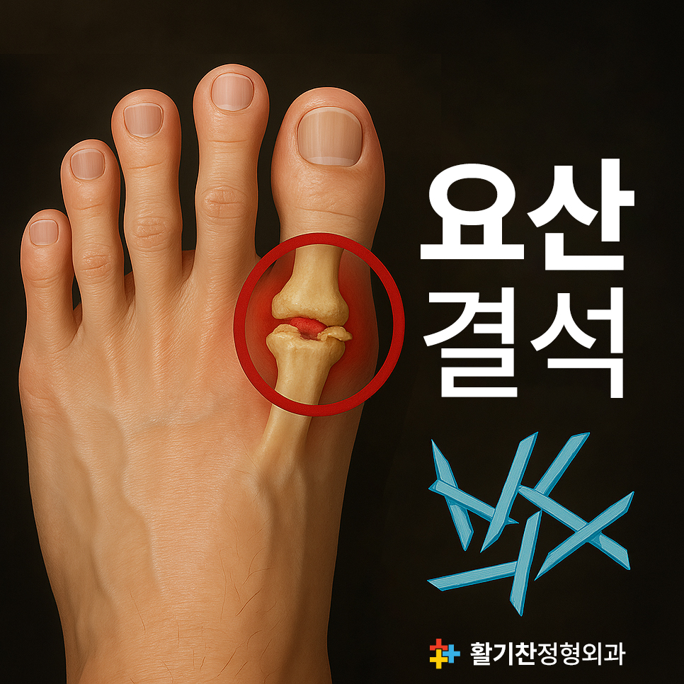 불광동통풍, 4050대 남성 특히 극심한 관절 통증 조심 (3).jpg