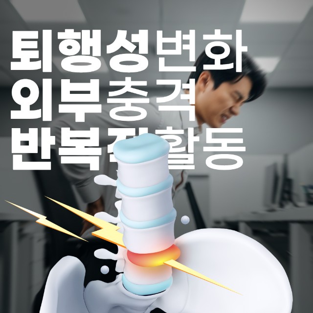 대조동허리디스크, 수술 없이 극복 가능! 현명한 비수술 치료법 (5).jpg