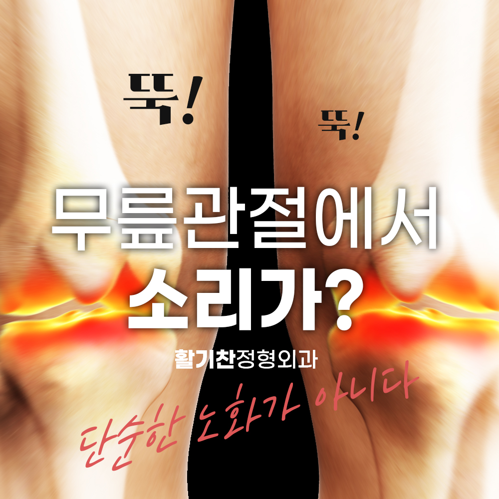 은평구정형외과, 무릎소리 나면 퇴행성 관절염 젊은 층도 안심 금물 (2).jpg