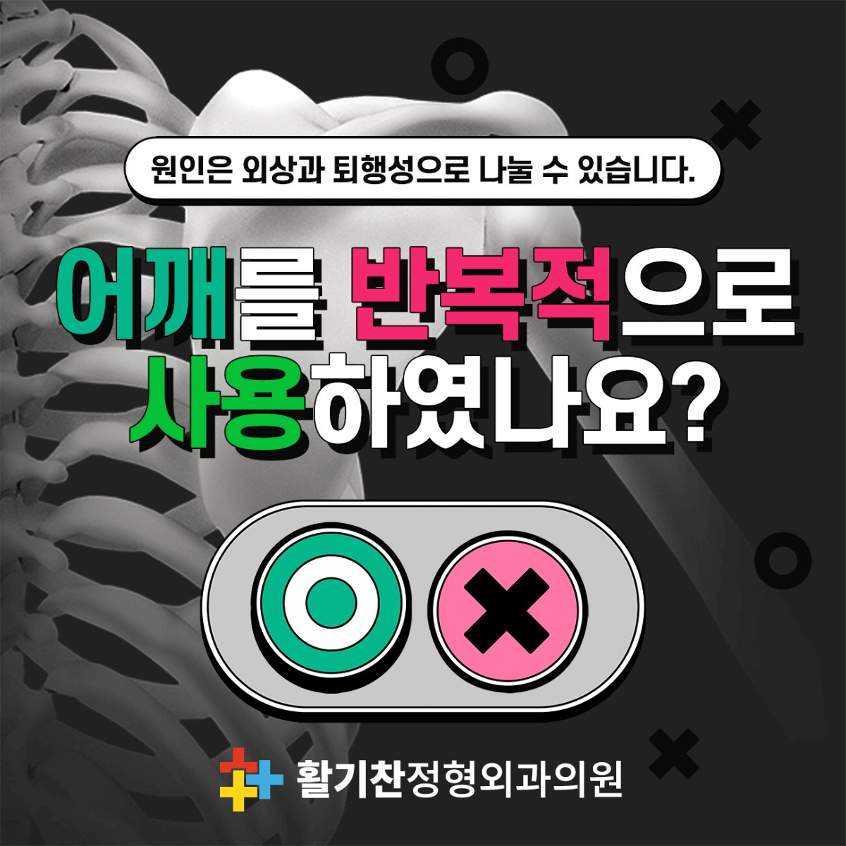 은평구어깨통증, 이 증상 있다면 회전근개파열 의심 (2).jpg