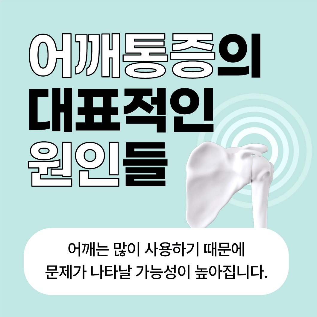 은평구어깨통증, 이 증상 있다면 회전근개파열 의심 (5).jpg