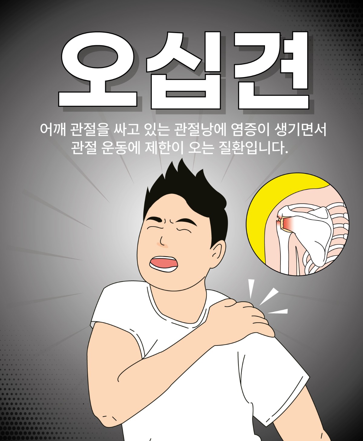 은평구 어깨 통증 오십견 vs 석회성건염 차이점과 예방법 (3).jpg